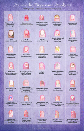 Ayurvedic Fingernail Analysis chart 11x17 - Ayurveda Posters